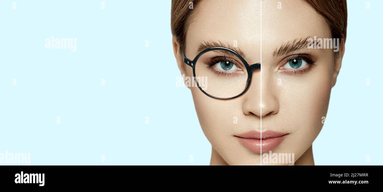 Laser-Vision-Korrektur. Frauengesicht mit und ohne Brille auf blauem Hintergrund, das das Konzept der Sehkorrektur mit Brillen zeigt Stockfoto
