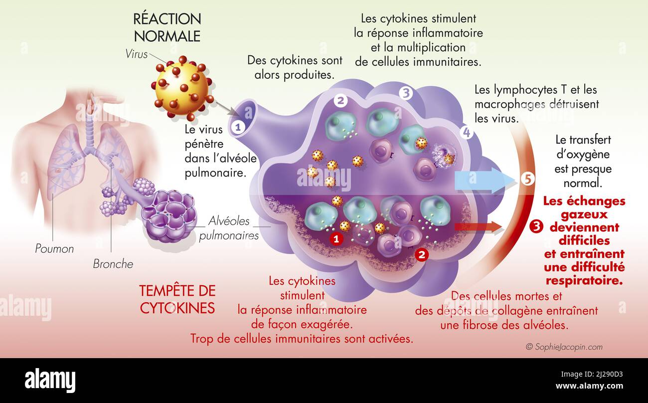 Cytokinic Sturm Stockfoto
