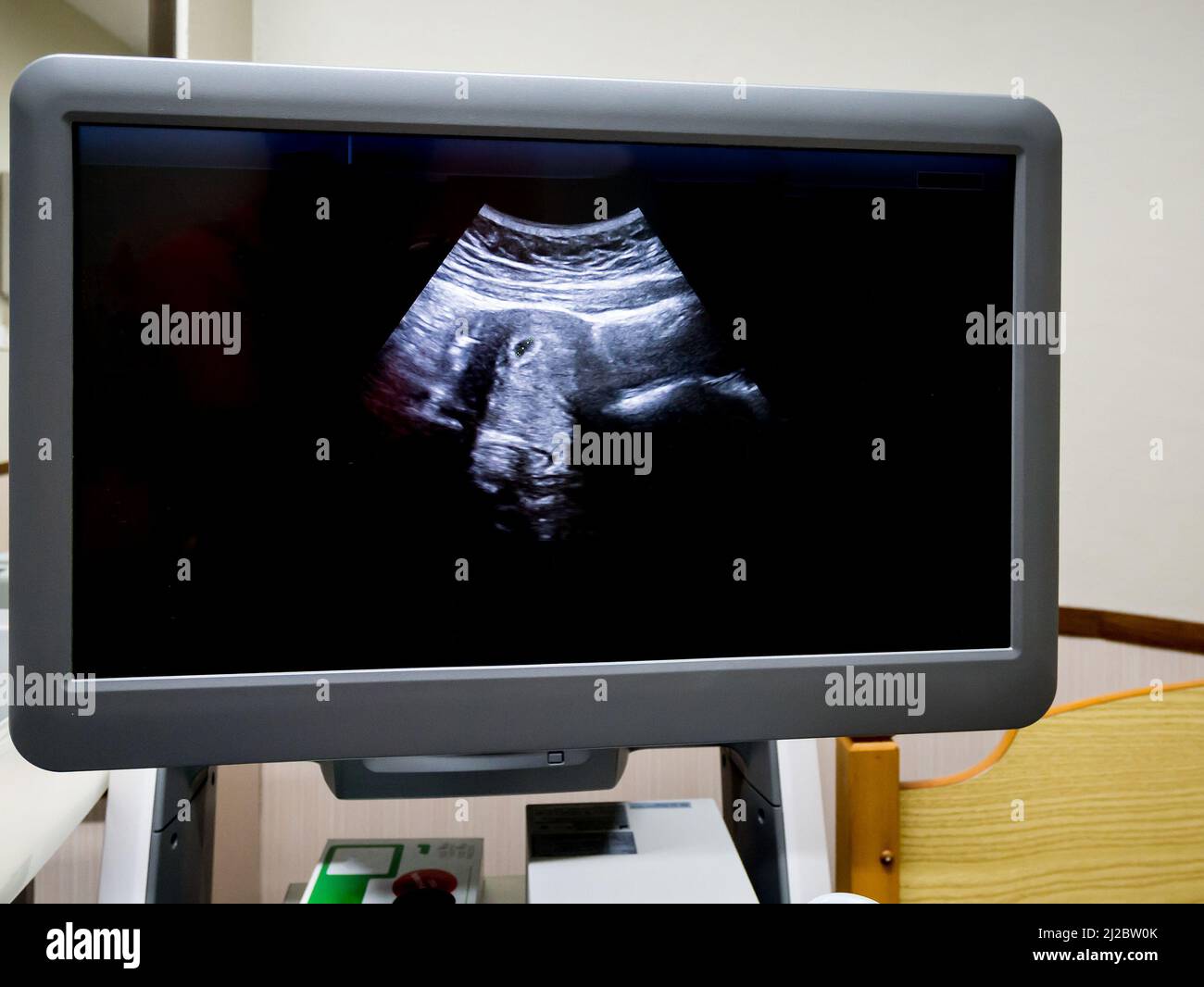 Medizinisches Ultraschallgerät im Krankenhausdiagnostikraum Stockfoto