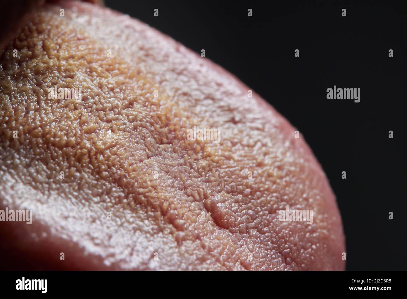 Gehen Risse In Der Zunge Wieder Weg Zunge mit Geschwüren des erwachsenen Mannes.Risse in der Zunge eines