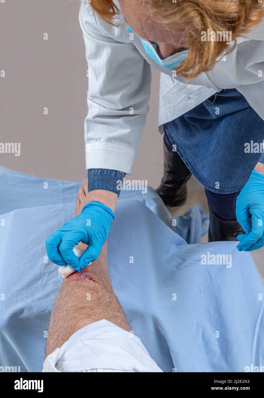 Krankenschwester Pflege frisch blutige Verletzung Wunde auf dem Tibiabaum des Beins. Klebende Stiche, um den Schnitt zu halten. Stockfoto