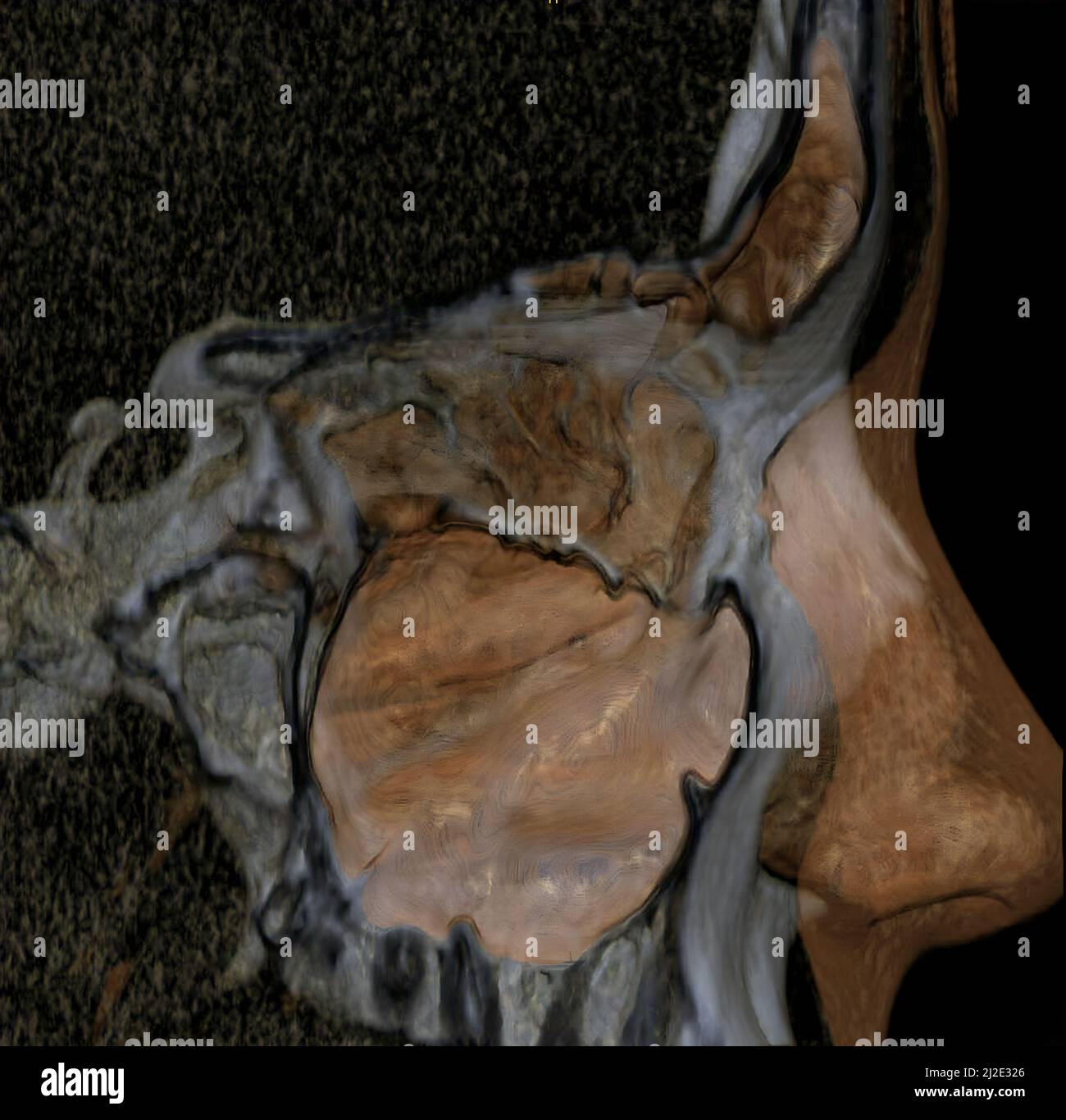 Sinus, Scan Stockfoto