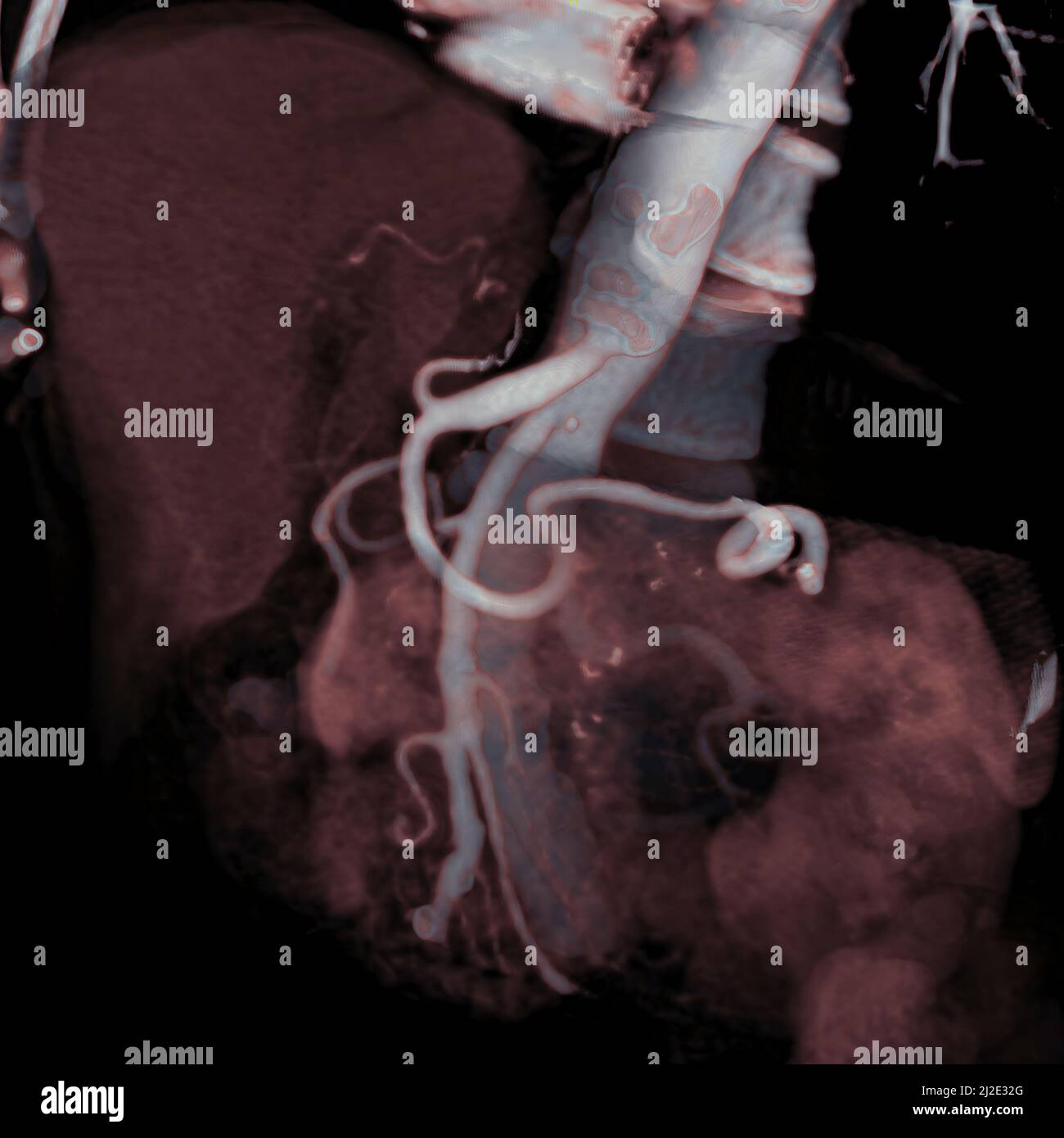 Bauch, scan Stockfoto