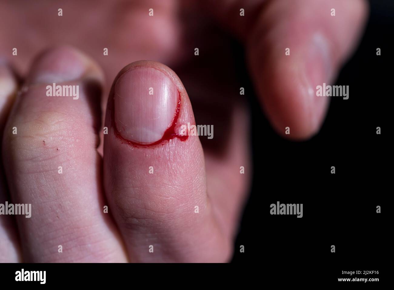 Messer schneiden Finger blutende Makro blutige Finger Scheibe. Stockfoto