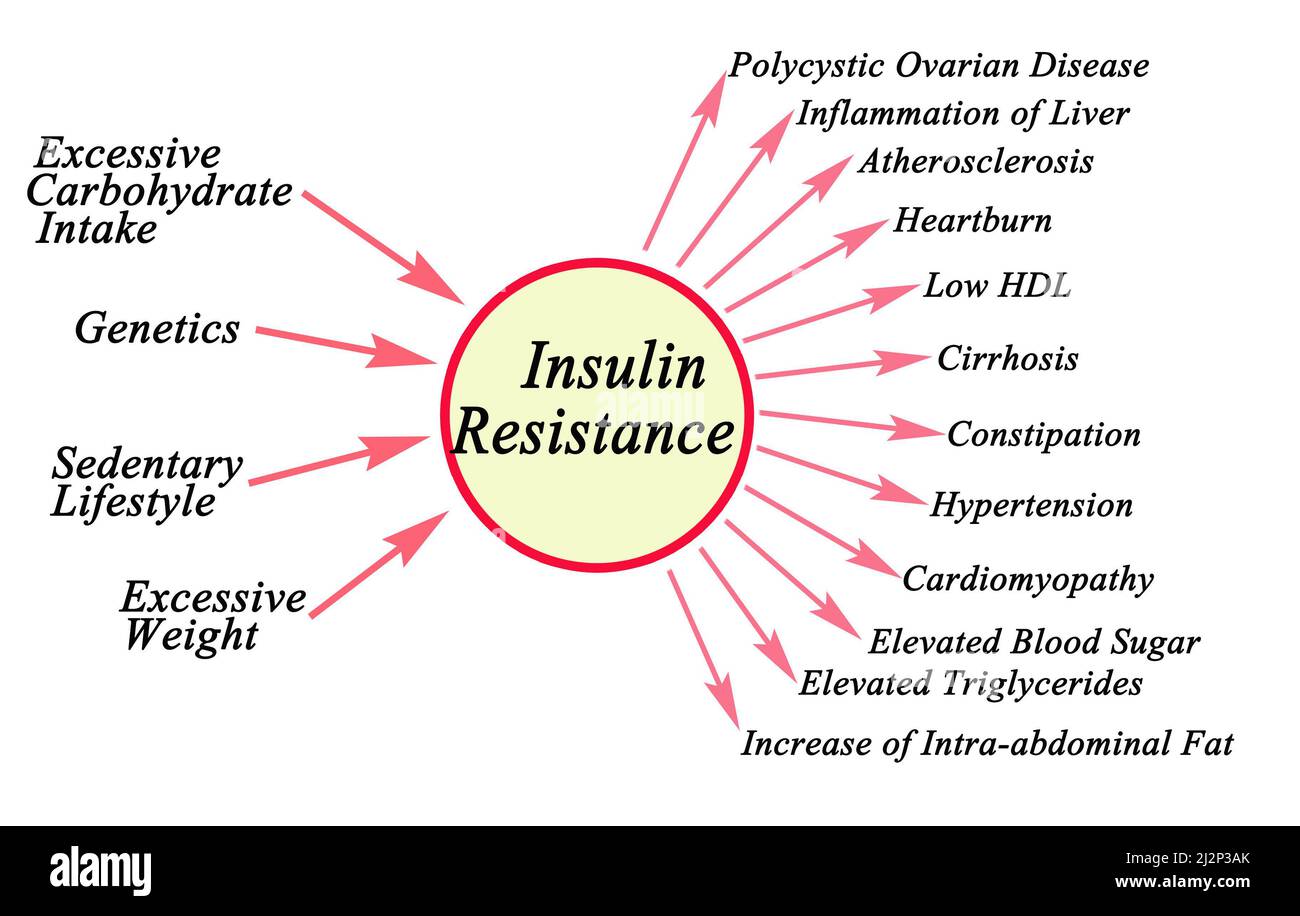 Ursachen und Folgen der Insulinresistenz Stockfoto