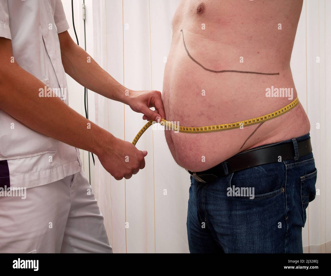 Niederlande, übergewichtiger Mann im Krankenhaus, weil er sein Gewicht, seinen Zuckerspiegel und seinen allgemeinen Gesundheitszustand überprüft hat. Eine Krankenschwester misst die Größe seines Bauches Stockfoto