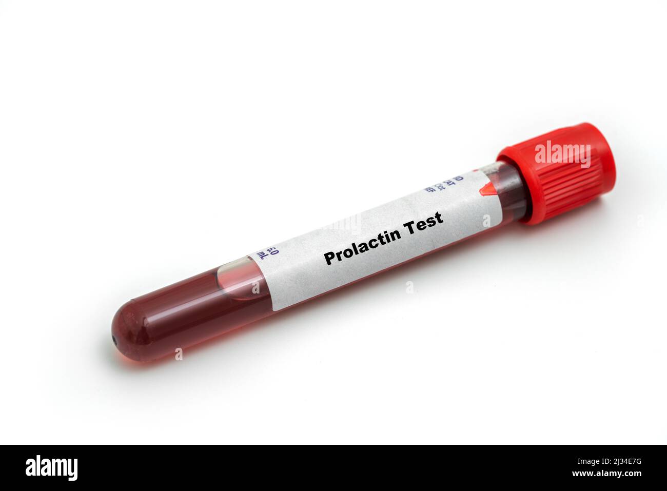 Prolaktin-Test Stockfoto