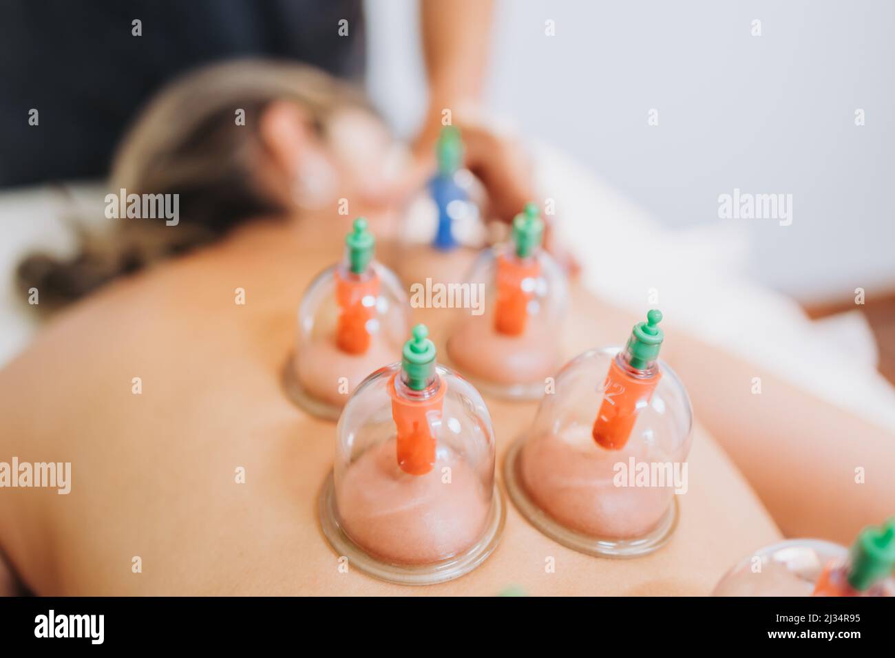 Saugnäpfe, die von einem Masseur auf den Rücken einer Patientin gelegt  werden. Medizinisches Spa-Massagezentrum Stockfotografie - Alamy