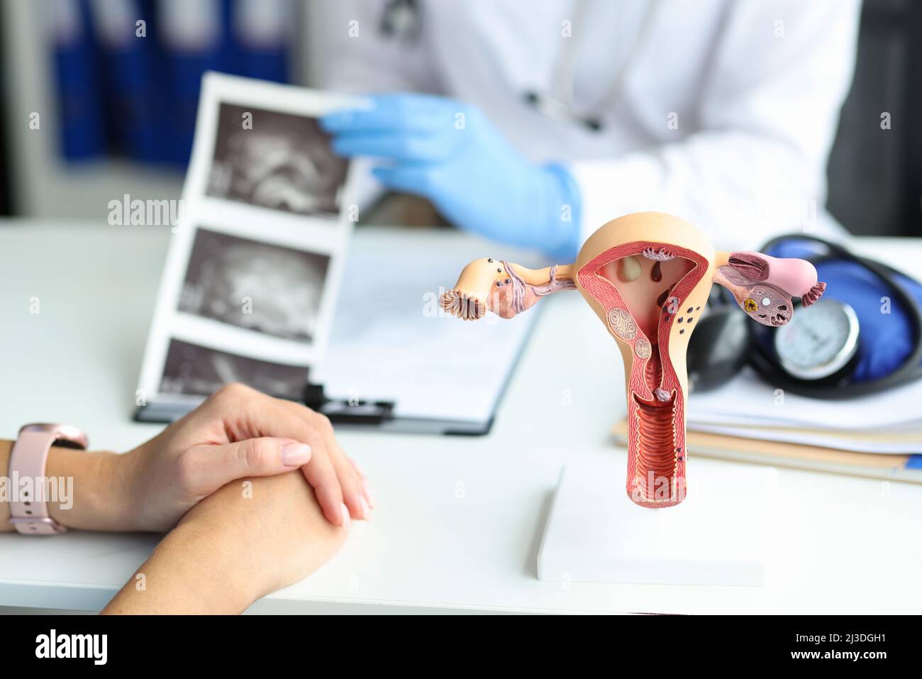 Gynäkologe konsultiert Frau mit Ultraschall-Scan des Uterus Stockfoto