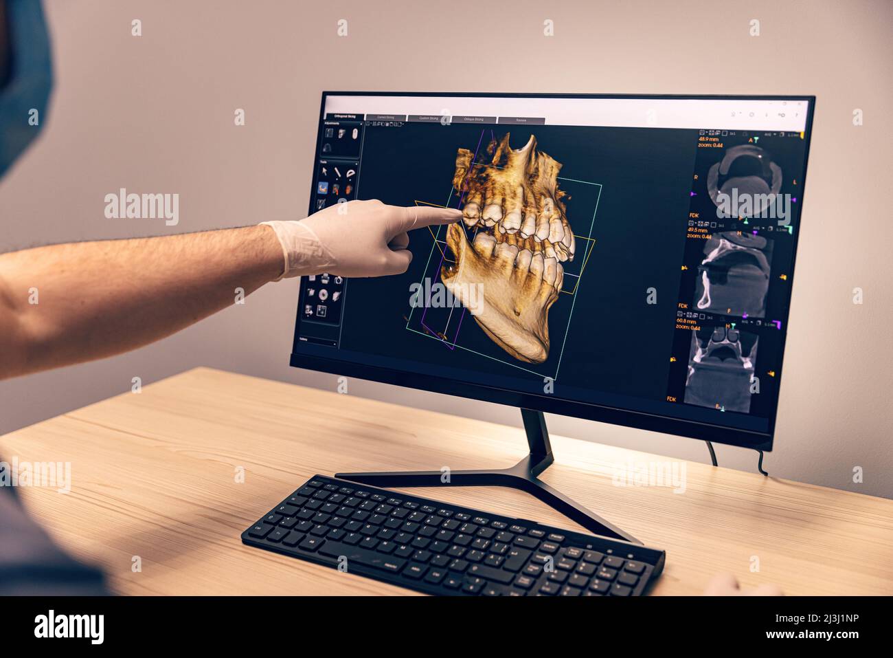 Die Hände des Arztes Zahnarzt in Handschuhen zeigen die Zähne auf dem Röntgenbild auf dem digitalen Bildschirm in der Zahnklinik Stockfoto