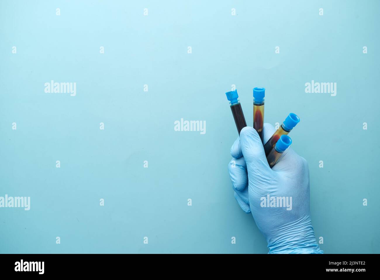 Hand in blauen medizinischen Handschuhen, die den Blutschlauch halten Stockfoto