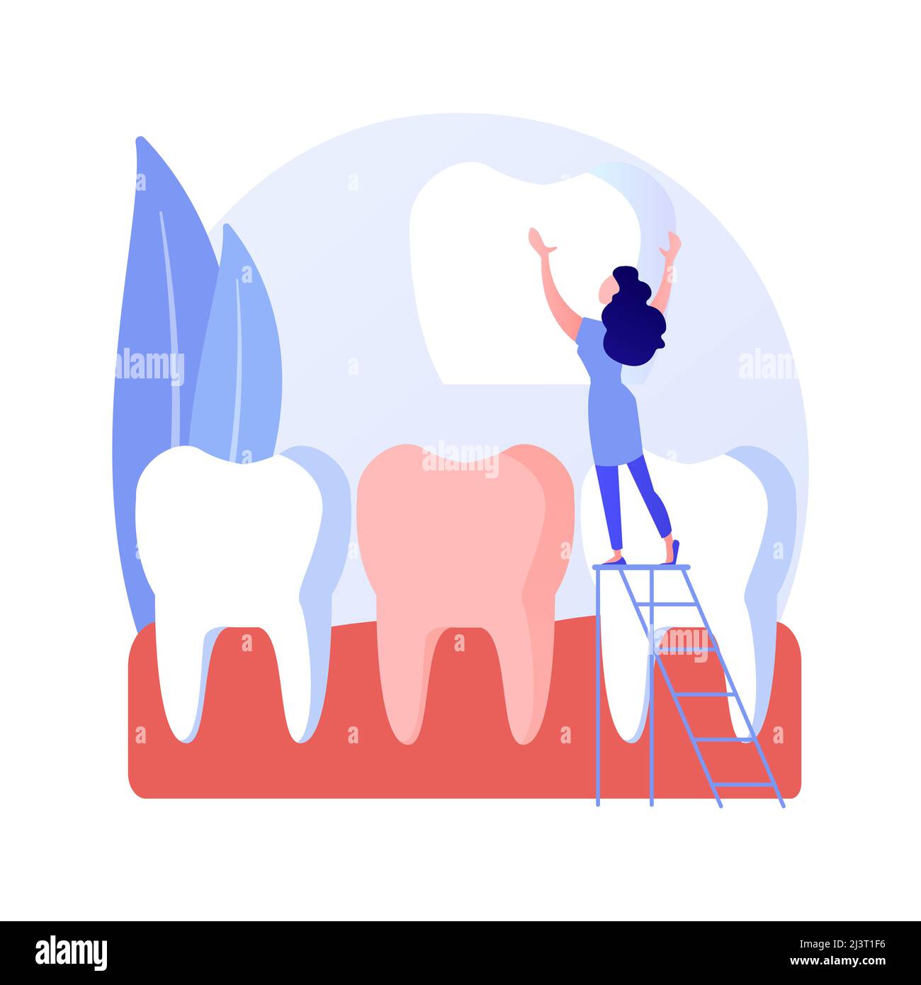 Zahnfurniere abstraktes Konzept Vektor Illustration. Furnier Platzierung, zahnärztliche Beauty-Lösung, Zahnästhetik, kosmetische Zahnmedizin Service, orthodont Stock Vektor