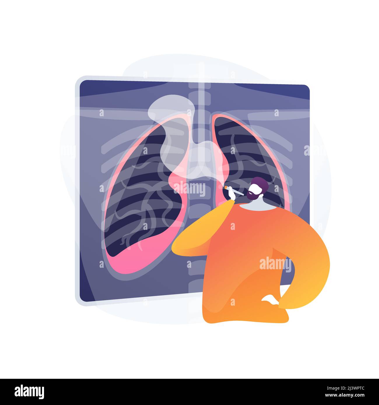 Ungesunder Lebensstil, Mann Rauchen Zigarette. Raucher schädigende Lungen, Atemwegserkrankung Gefahr. Nikotinsucht, schädliche Gewohnheit, Gesundheitsgefährdung. Vecto Stock Vektor