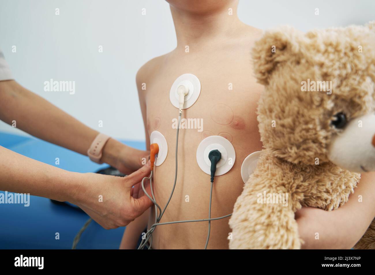 Kinderarzt überprüft den Herzrhythmus des Kindes mit dem EKG-holter-Monitor Stockfoto