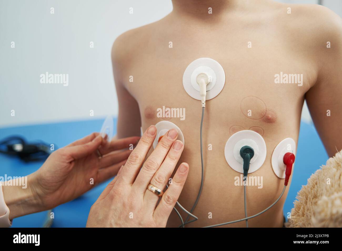 Arzt überprüft den Herzrhythmus eines Kindes mit dem EKG-holter-Monitor Stockfoto