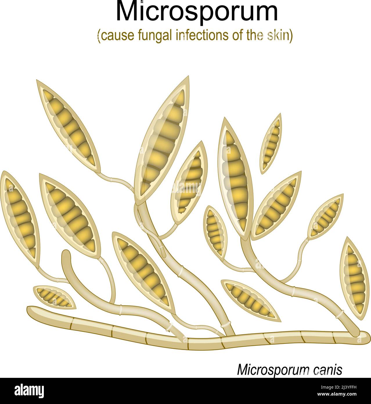 Microsporum, unter dem Mikroskop. Mikroskopische Pilze, die Infektionen der Haut, der Haut des Körpers und der Füße verursachen. vektordarstellung Stock Vektor