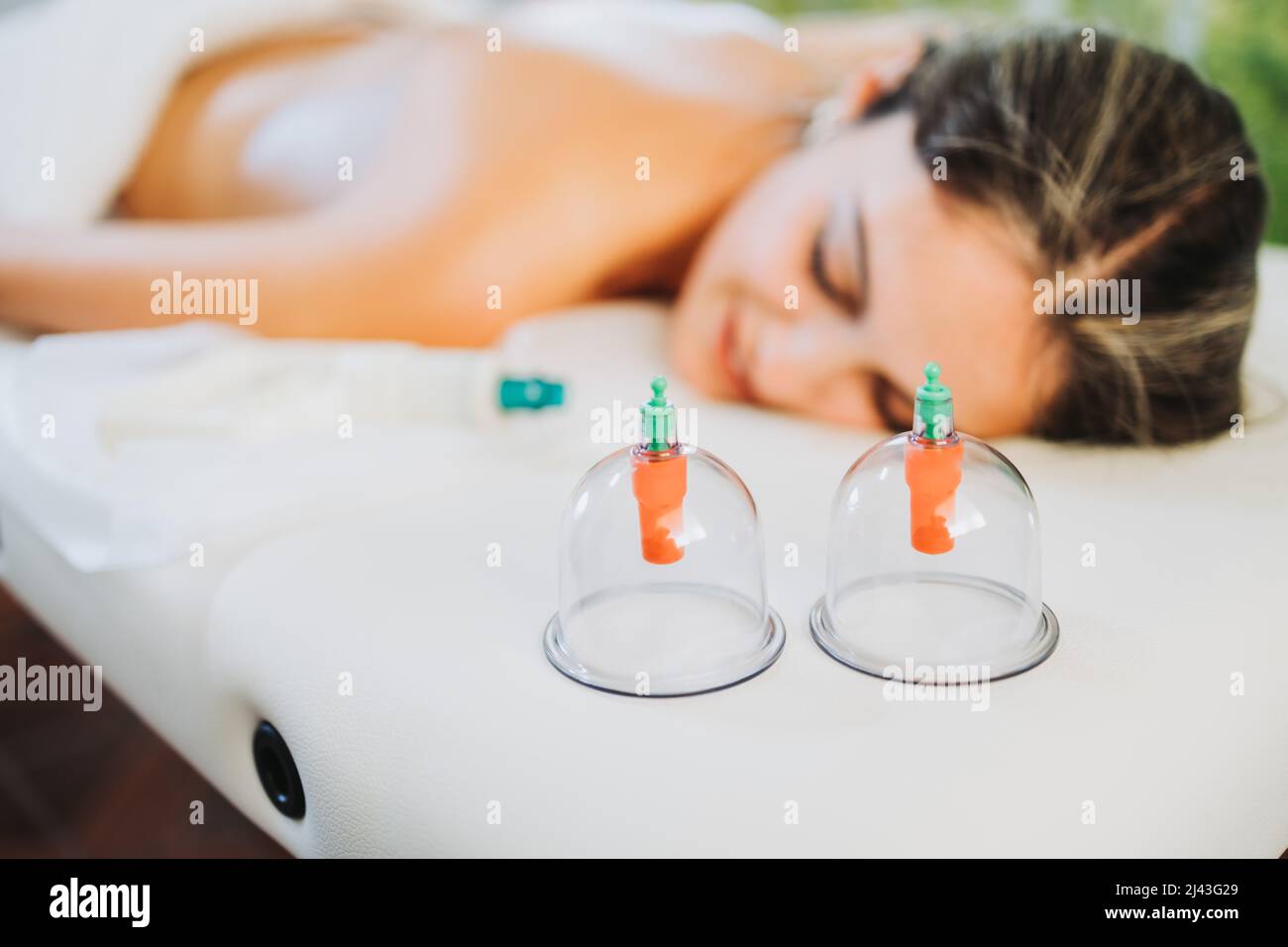 Saugnäpfe, die von einem Masseur neben einer weiblichen Patientin platziert werden. Medizinisches Spa-Massagezentrum. Stockfoto