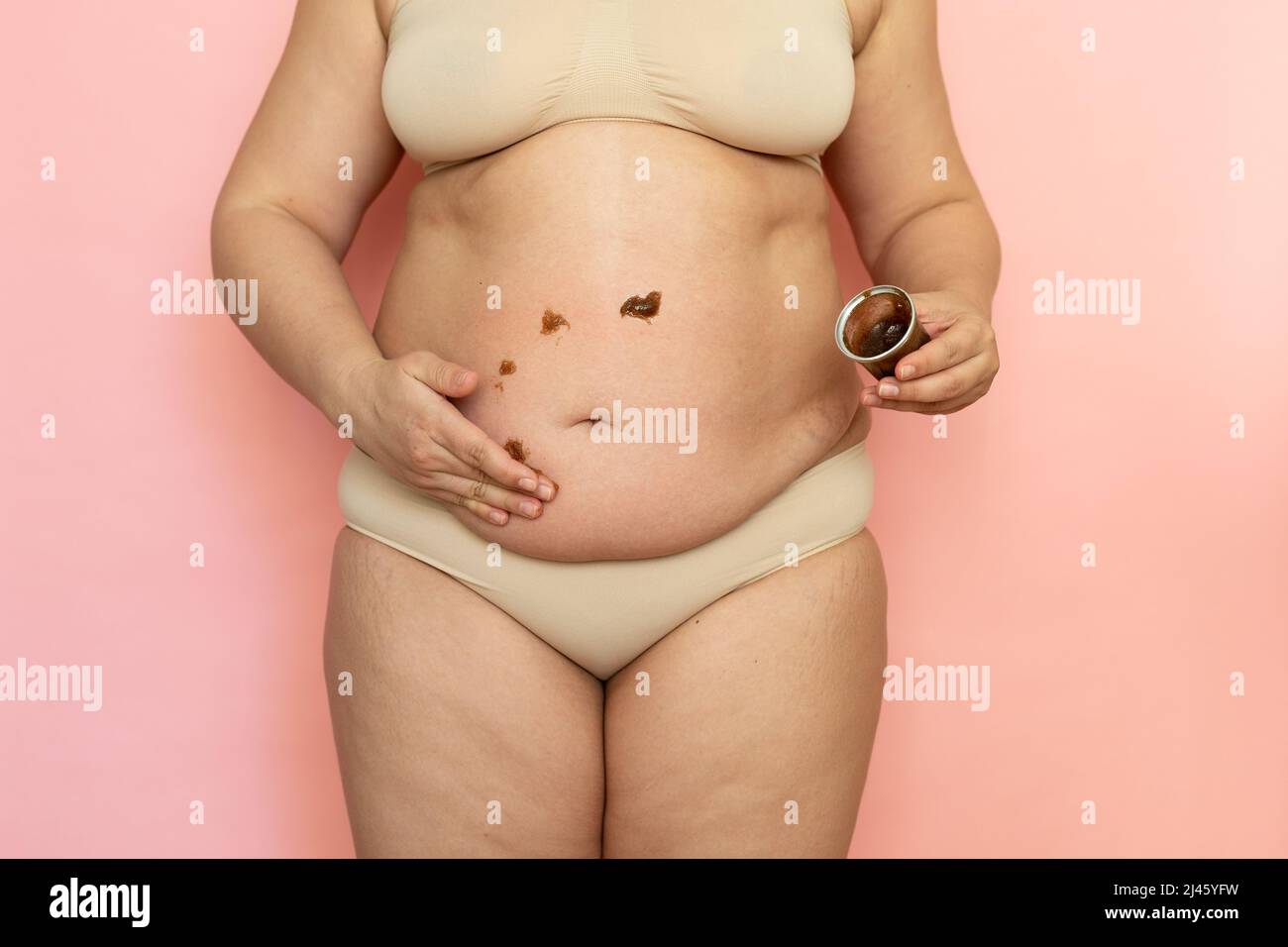 Ein kurzer Schnitt von übergewichtiger, fetter Frau mit Bauchmabs. Anti-Cellulite-Creme Malerei auf dem Bauch. Vermeidung von Dehnungsstreifen Stockfoto