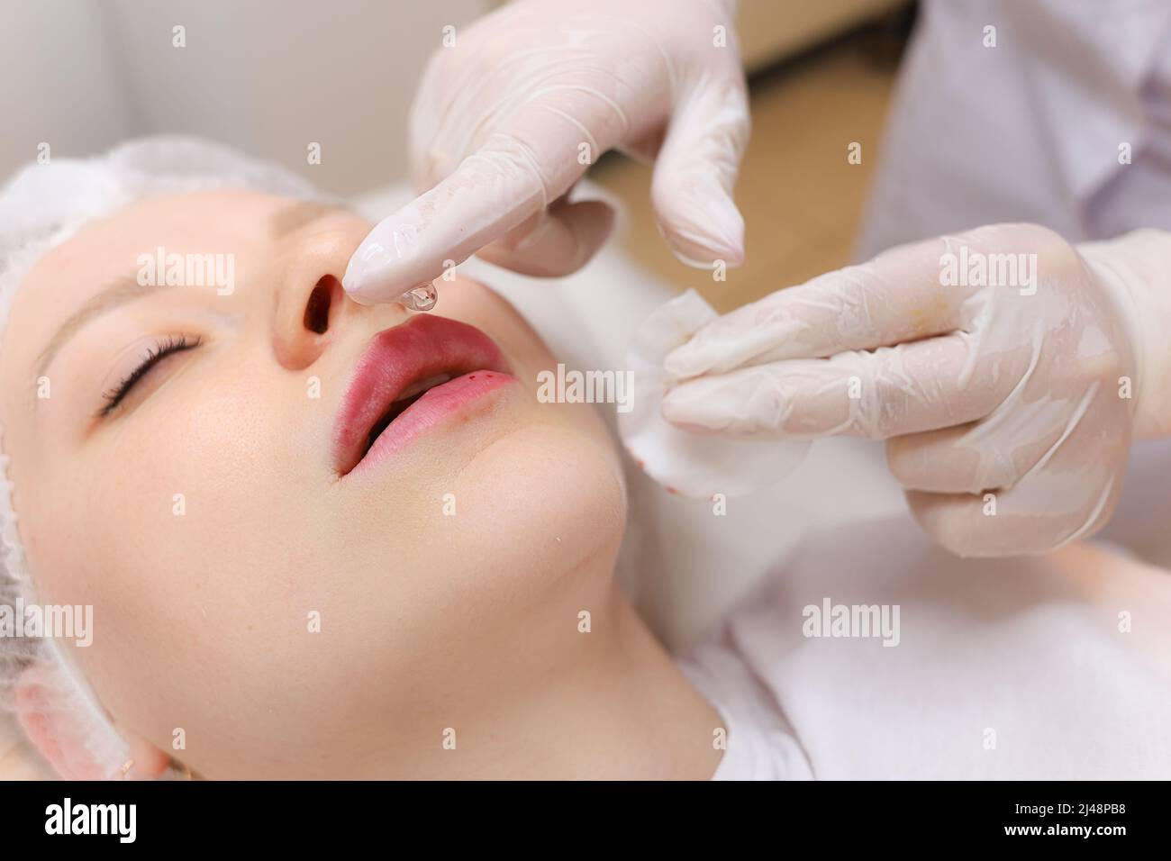 Die Kosmetikerin hält nach der Injektion von Hyaluronsäure einen Tropfen Öl auf ihre Finger vor den Lippen des Mädchens Stockfoto