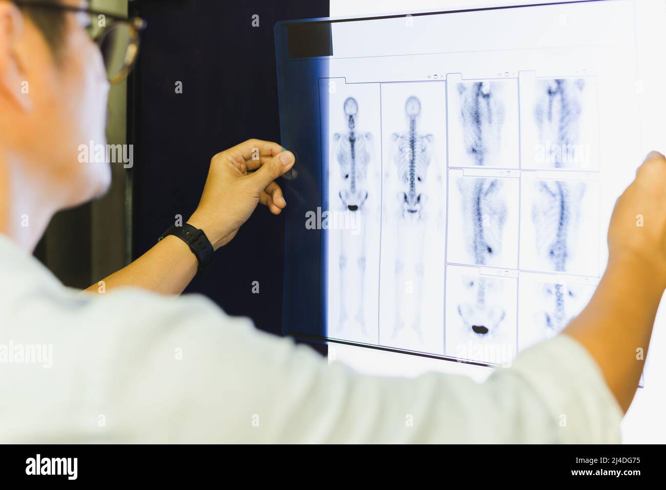 Seitenansicht eines Arztes, der die menschliche Röntgenaufnahme betrachtet. Stockfoto
