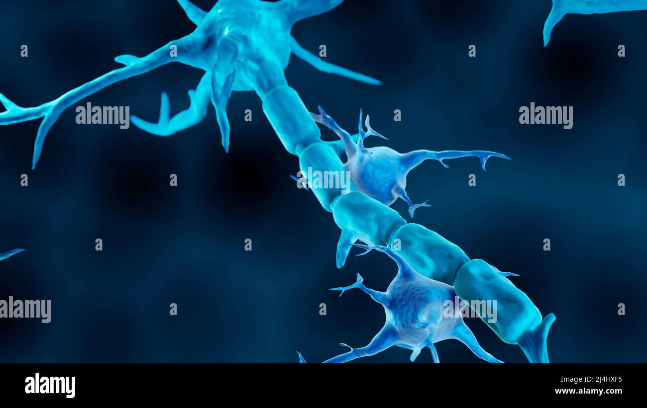 Multiple Sklerose, Illustration Stockfoto