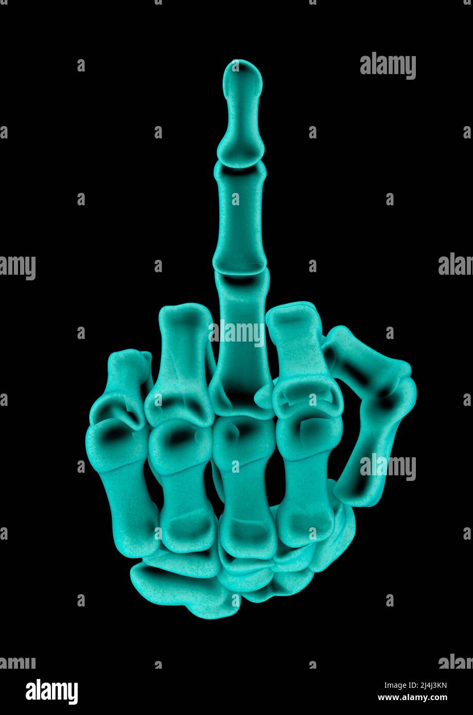 Röntgenaufnahme des Mittelfingers - 3D Abbildung der gerönten Skeletthand mit unfreundlicher Handbewegung Stockfoto