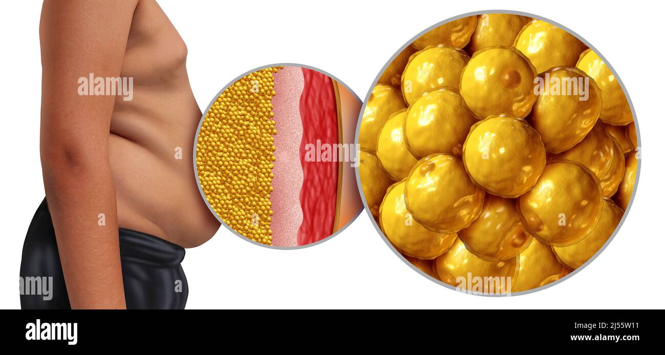 Adipositas und Fettzellen oder Adipocyte Konzept als Bauch einer übergewichtigen Person als medizinische Körper Gesundheit Problem mit 3D Illustrationselementen. Stockfoto
