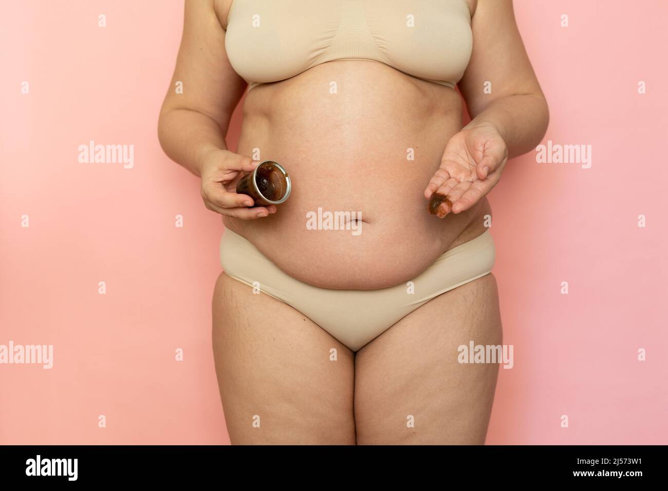 Ein kurzer Schnitt von übergewichtiger, fetter Frau mit Bauchmabs. Anti-Cellulite-Creme Malerei auf der Haut. Adipositas-Problem. Nahaufnahme Stockfoto