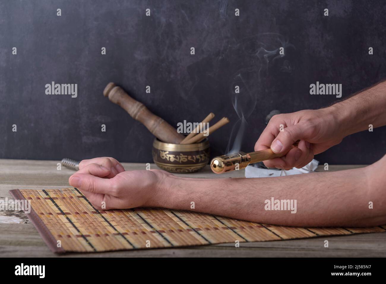 Moxibustherapie - traditionelle Chinesische Medizin. Platzierung des brennenden Moxa-Sticks auf dem Arm. Stockfoto