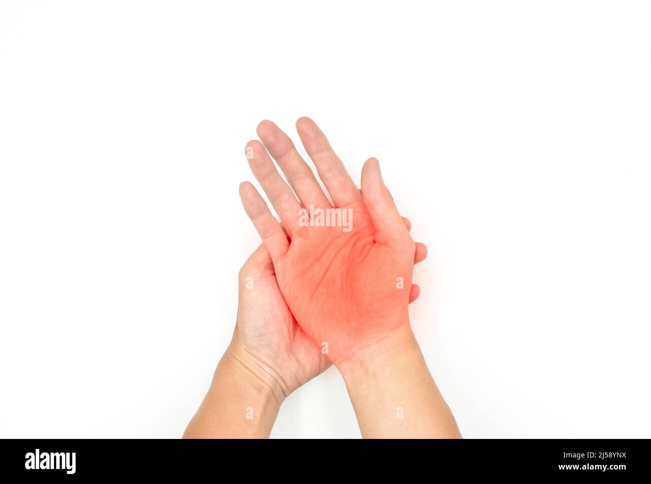 Schmerzhafter Palmar-Aspekt des asiatischen jungen Mannes. Konzept des Kompartiment-Syndroms und Schmerzen der Handmuskulatur. Stockfoto