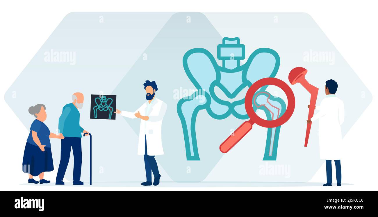 Vektor eines Arztes, der älteren Menschen ein Hüftersatzverfahren erklärt Stock Vektor