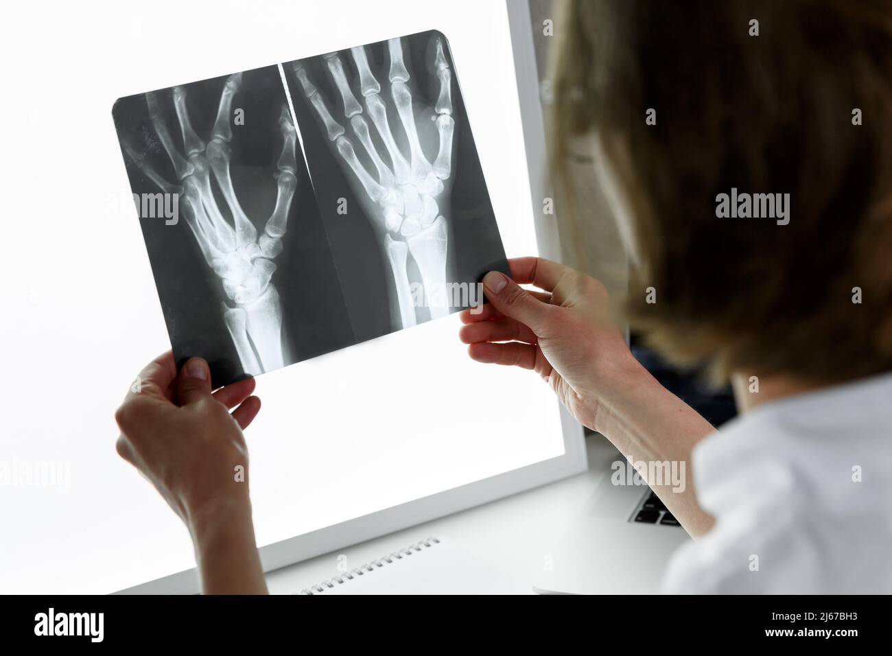 Chirurg Traumatologe untersucht eine Röntgenaufnahme des traumatisierten Handgelenks. Konzept der Gesundheitsversorgung und Krankenversicherung Stockfoto