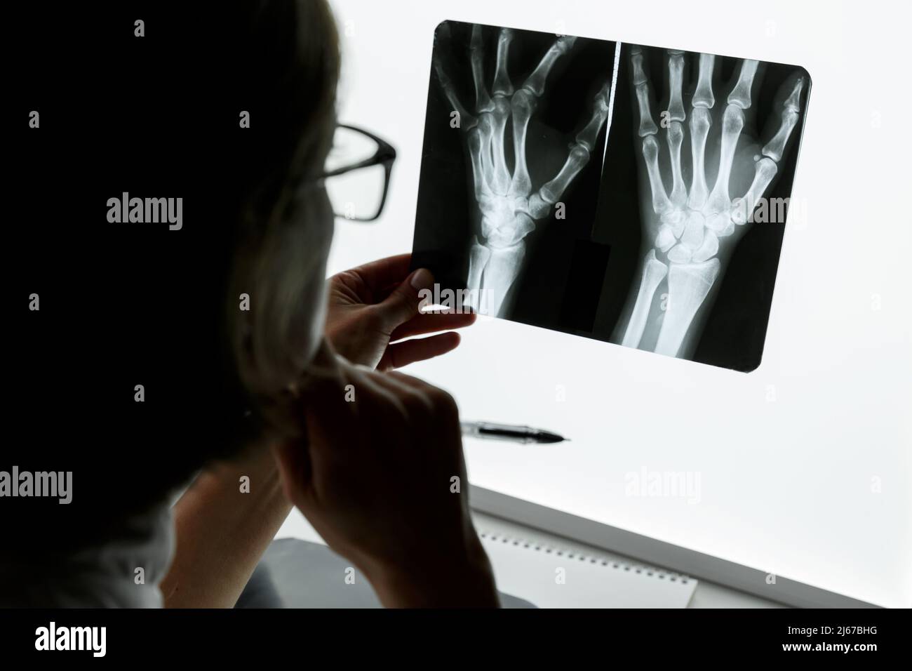 Chirurg Traumatologe untersucht eine Röntgenaufnahme des traumatisierten Handgelenks. Konzept der Gesundheitsversorgung und Krankenversicherung Stockfoto