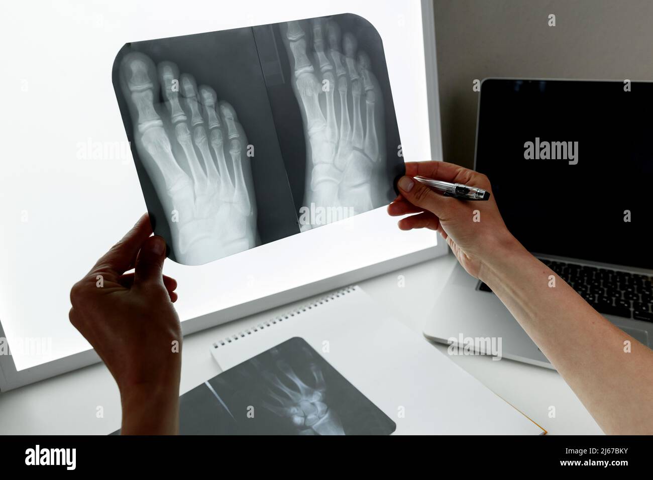 Orthopädischer Chirurg, der eine Röntgenaufnahme des Fußes untersucht. Konzept der Gesundheitsversorgung und Krankenversicherung Stockfoto