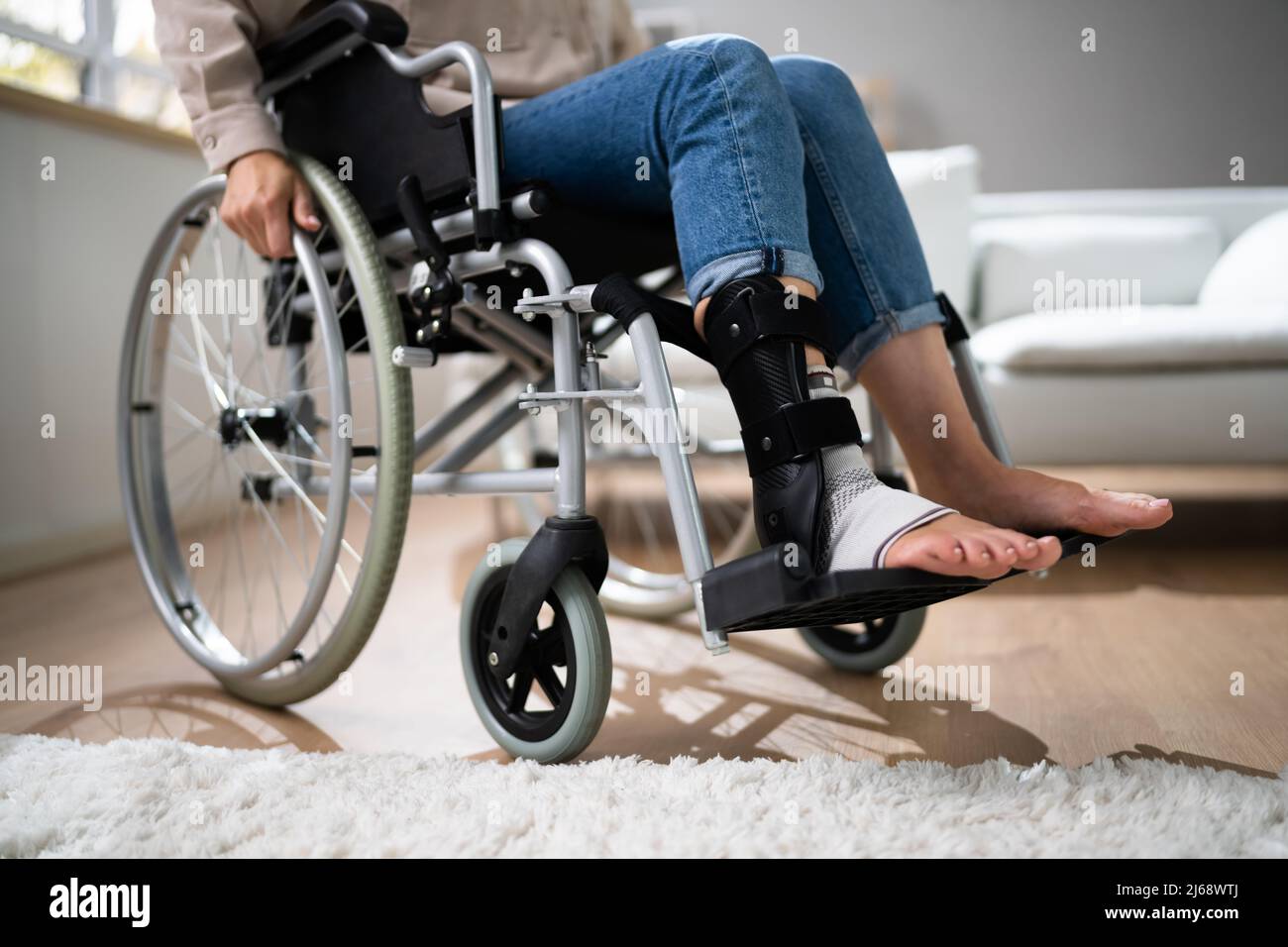 Junge Frau Im Rollstuhl. Behinderung Durch Medizinische Verletzungen Stockfoto