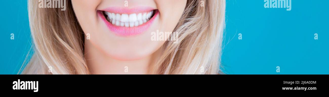 Perfekte gesunde Zähne. Nahaufnahme von Frau toothy Lächeln. Perfekte gesunde Zähne lächeln Frau. Zahnaufhellung. Zahngesundheit Konzept. Zähne Stockfoto