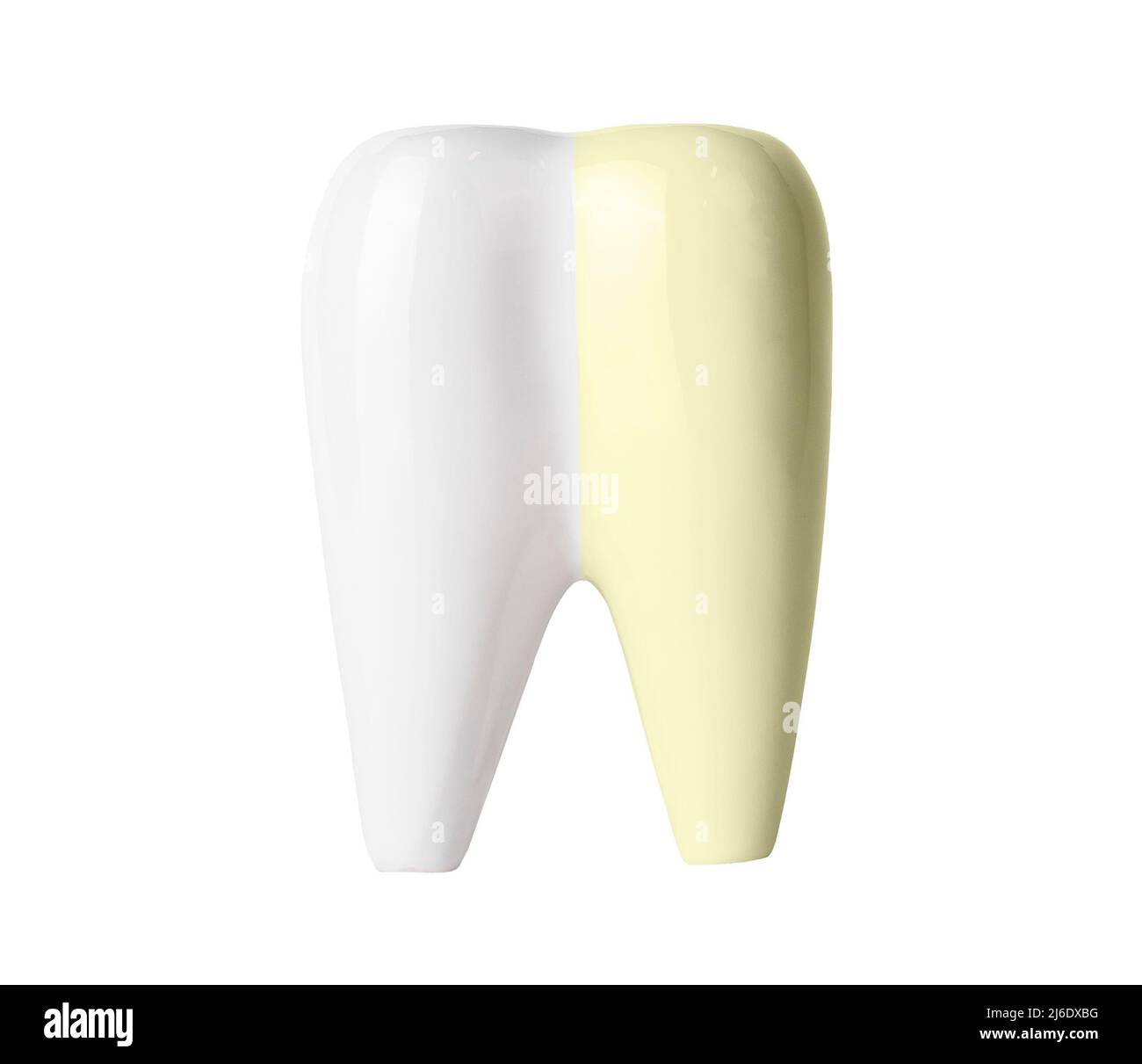 Zahnaufhellung vor und nach isoliert auf weißem Hintergrund. Professionelle Zahnreinigung und Bleichen, Zahnpflege und Mundhygiene Konzept. Hochwertige Fotos Stockfoto