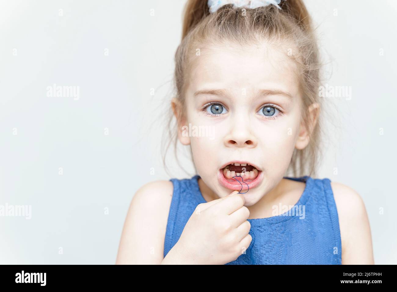 Ein 5-jähriges Mädchen hat einen losen Milchzahn. Das Baby Band den Zahn mit einem Faden und will ihn entfernen Stockfoto
