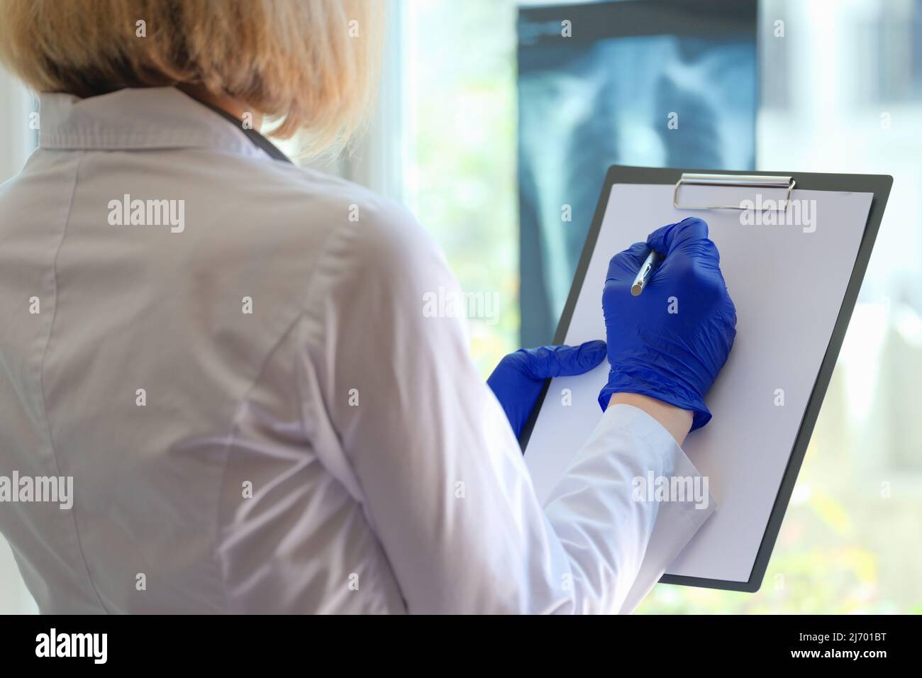 Die Hand des Arztes schreibt Notizen auf das Clipboard in der Medizin und schaut durch den Röntgenfilm Stockfoto