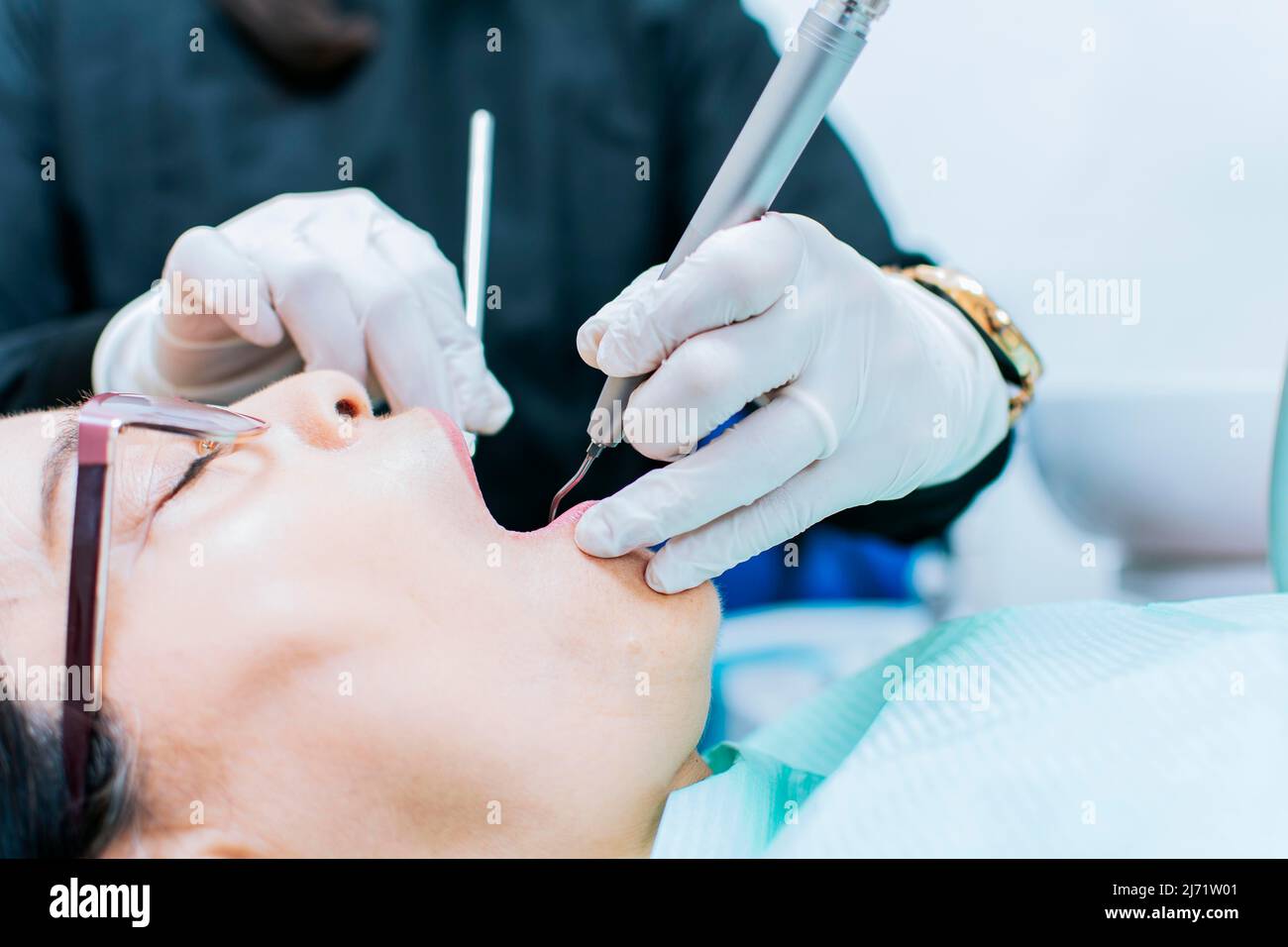 Nahaufnahme eines Patienten, der vom Zahnarzt untersucht wurde, eines Zahnarztes, der eine Wurzelkanalbehandlung am Patienten durchführt, eines Zahnarztes, der eine zahnärztliche Untersuchung durchführt Stockfoto