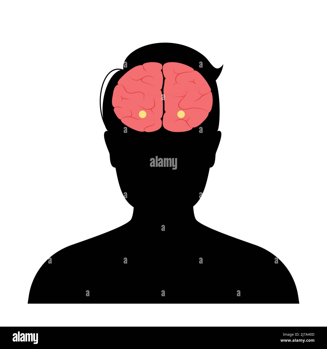 Gehirn Amygdala Anatomie, Illustration Stockfoto
