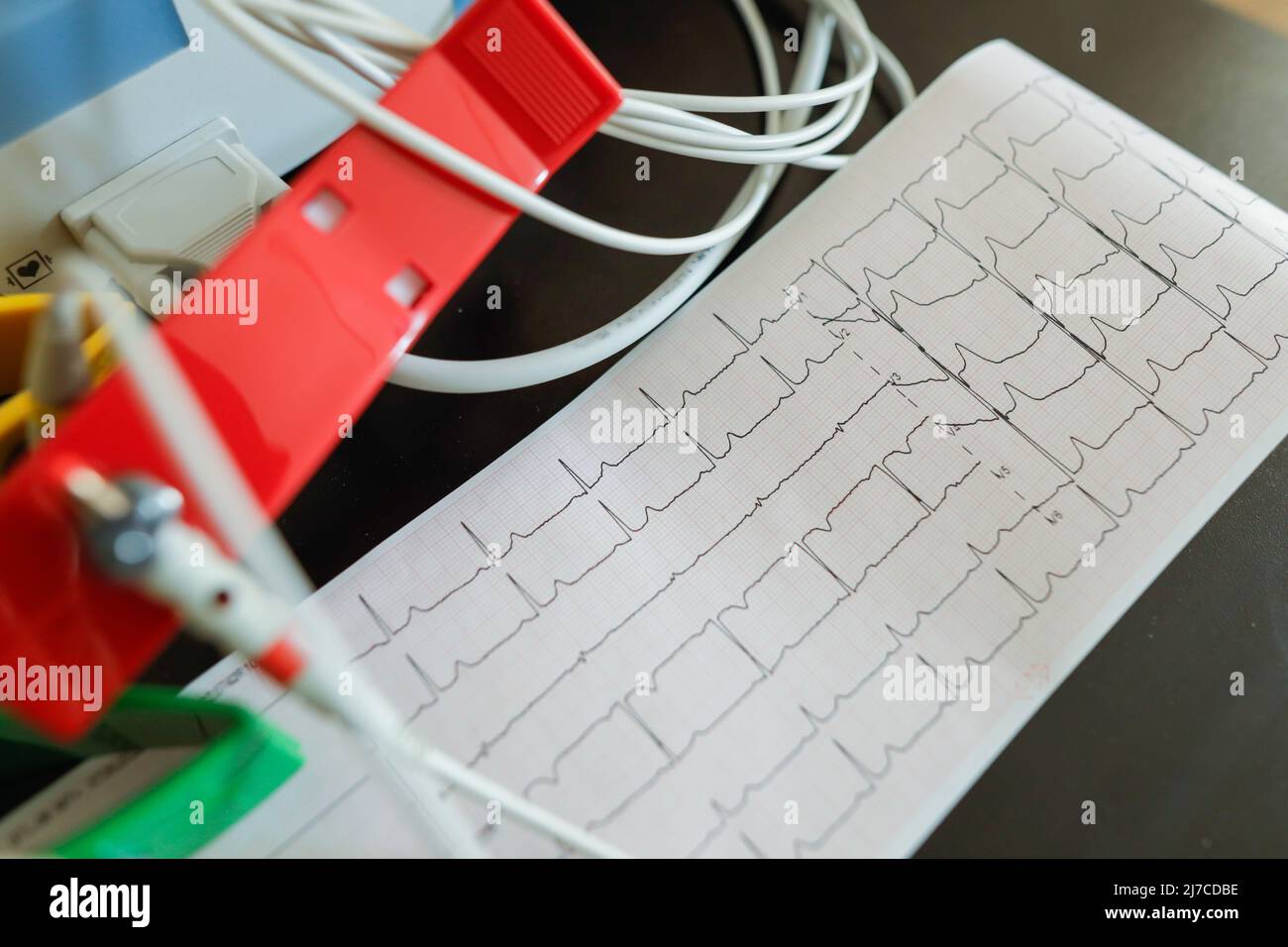 Details zur Schärfentiefe (selektiver Fokus) mit Elektroden aus einem Elektrokardiographie-Gerät und einem Elektrokardiogramm. Stockfoto