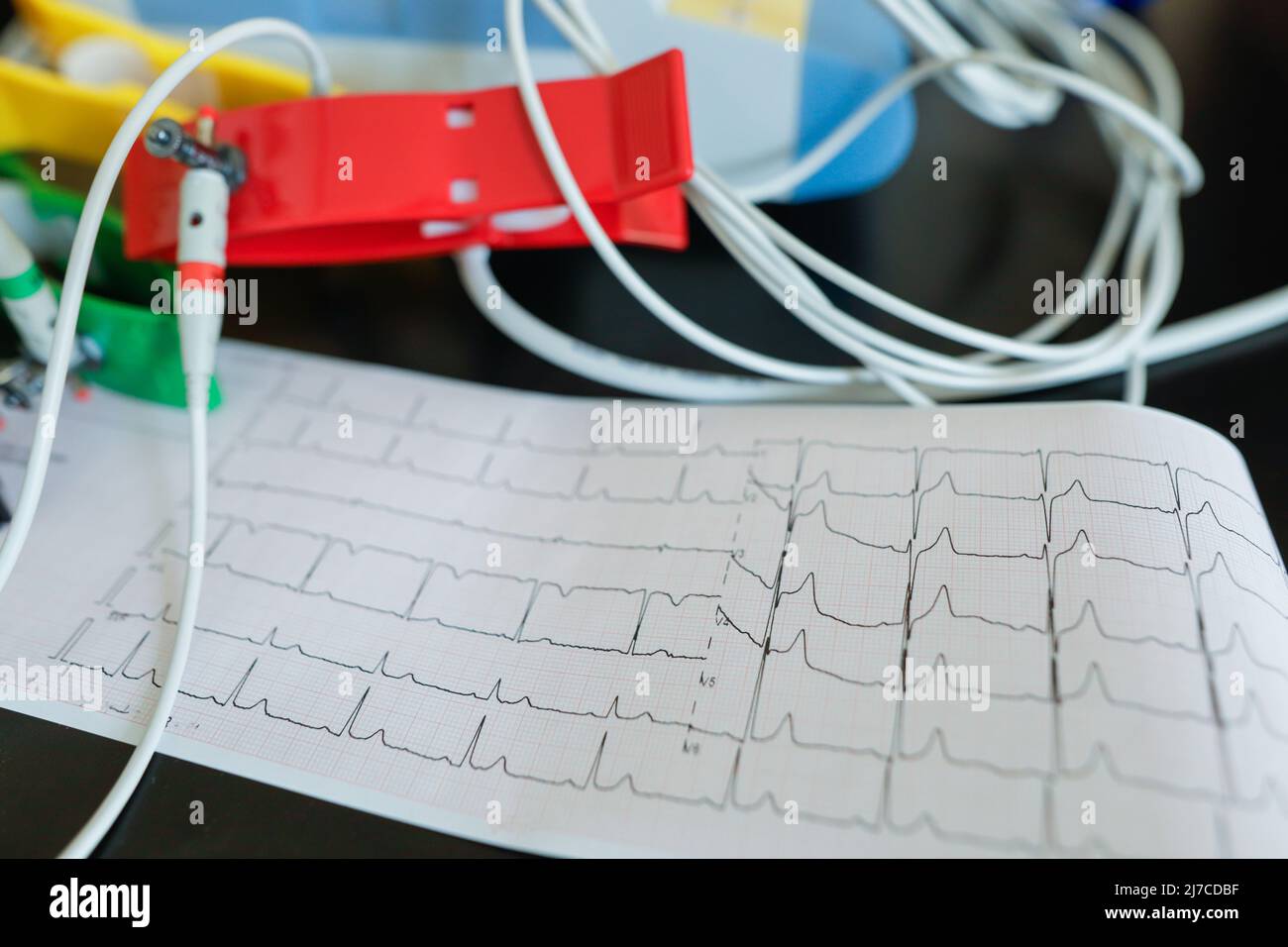 Details zur Schärfentiefe (selektiver Fokus) mit Elektroden aus einem Elektrokardiographie-Gerät und einem Elektrokardiogramm. Stockfoto