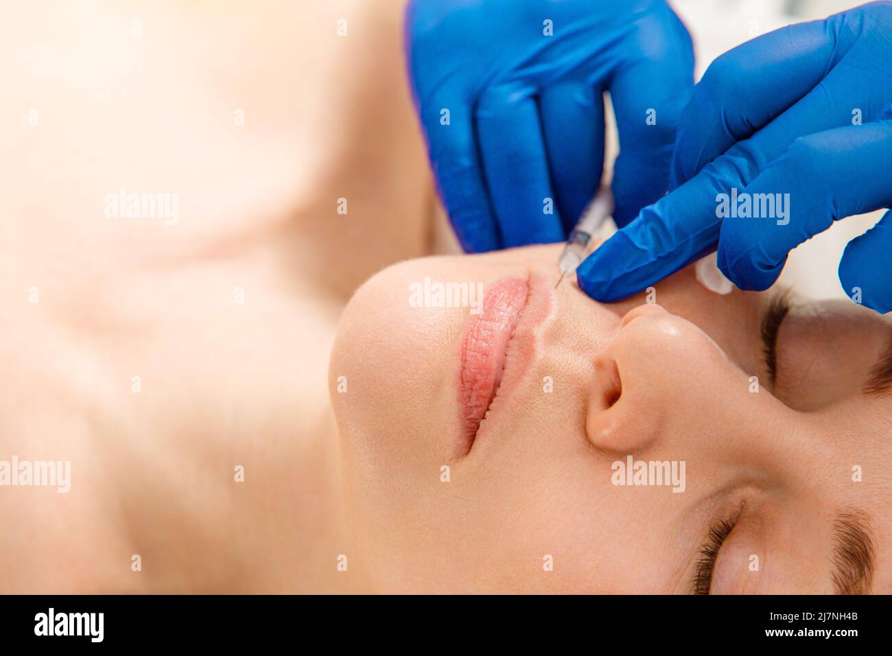 Nahaufnahme der Hände eines Kosmetologen, der Botox-Injektionen in die weiblichen Lippen macht. Korrektur der Lippenform, Lippenvergrößerung. Stockfoto