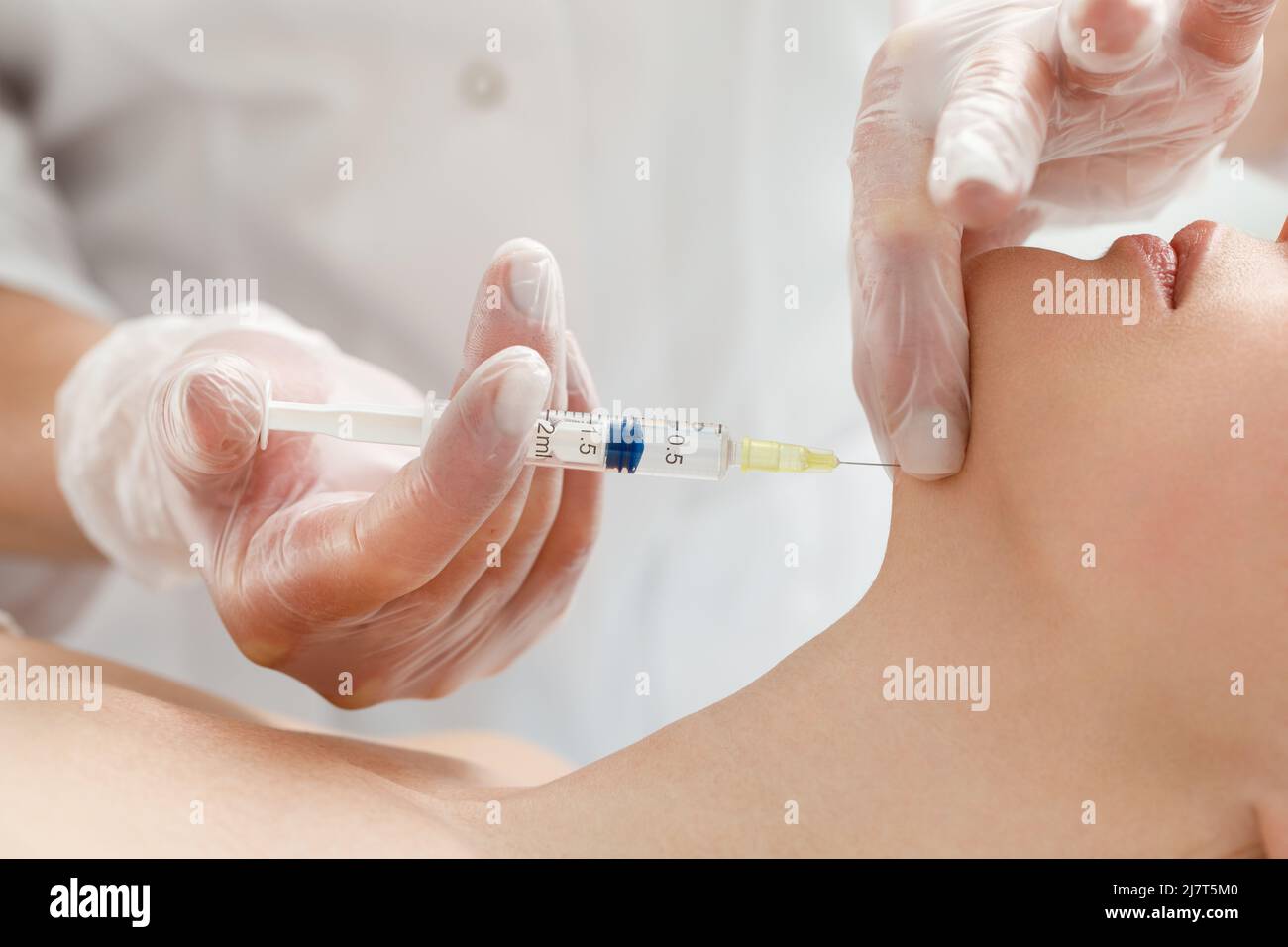 Der Kosmetologe führt das Kinnlift-Verfahren durch Injektionen von Schönheitsinjektionen durch. Arzt injiziert Hyaluronsäure in das ching einer Frau als Gesichtsbehandlung Stockfoto