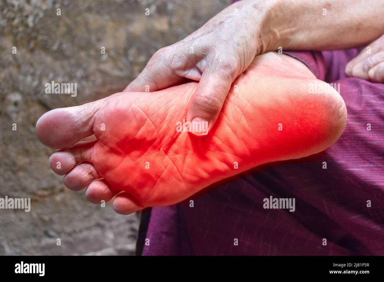 Kribbeln und Brennen im Fuß des asiatischen alten Mannes mit Diabetes.  Fußschmerzen. Sensorische Neuropathie Probleme. Probleme mit den Fußnerven.  Plantare Fasziitis Stockfotografie - Alamy