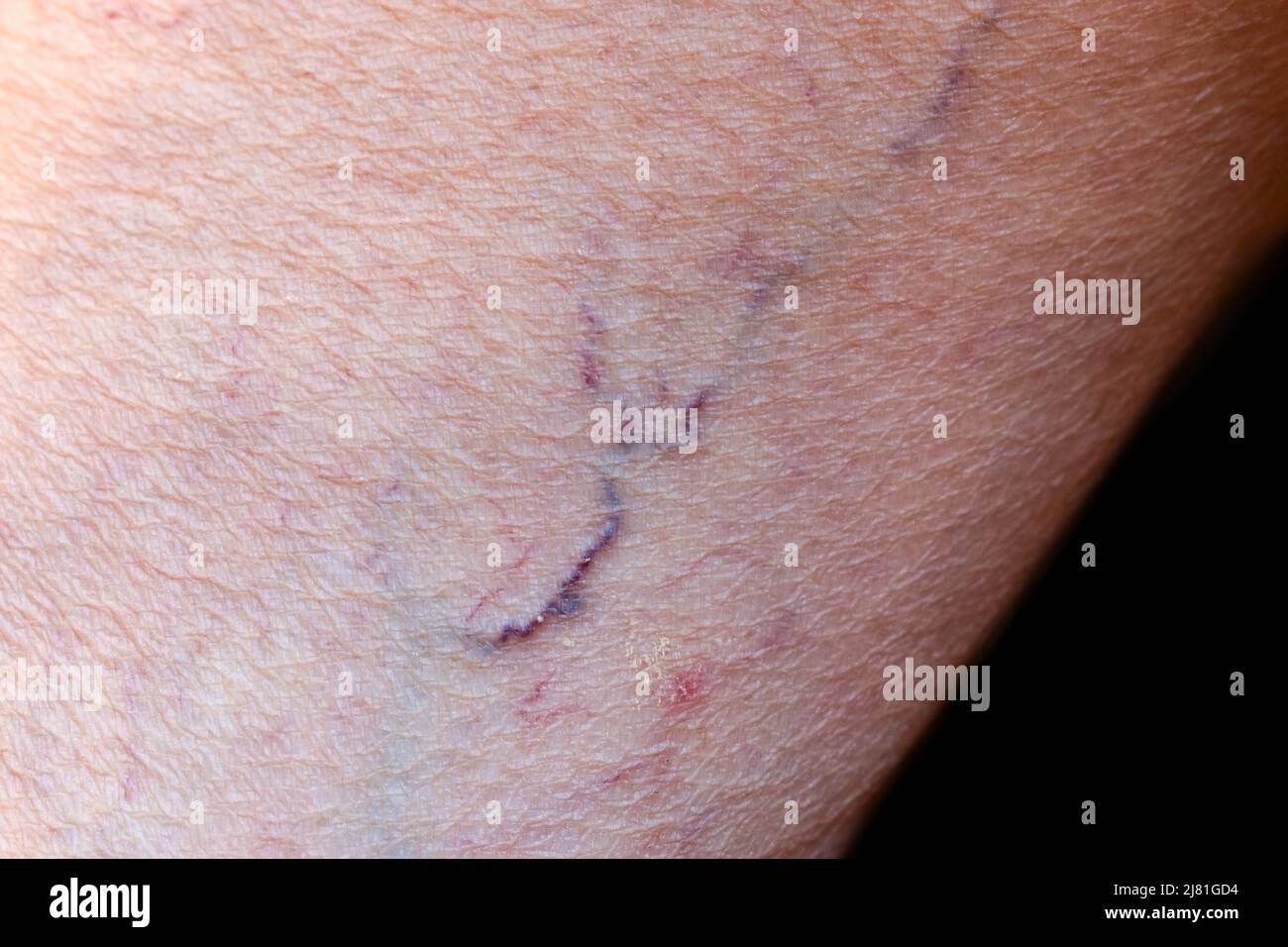 Prominente Venen sichtbar durch die dünne Haut der asiatischen alten Frau. Stockfoto