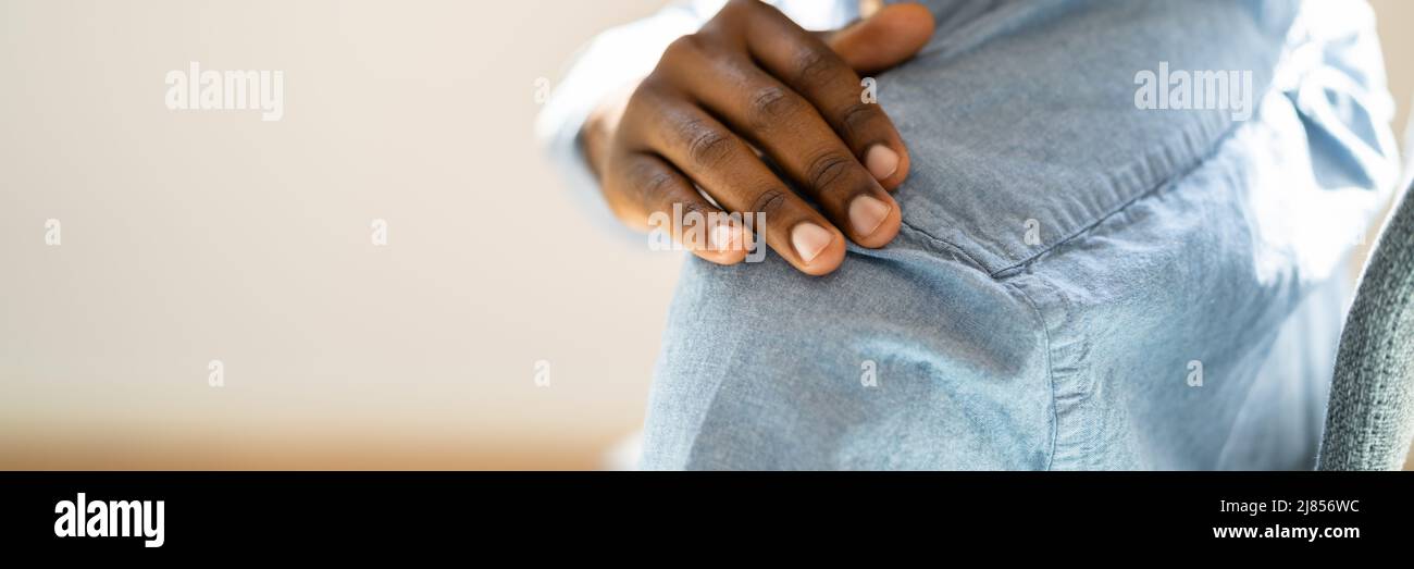 Bürsten Weiße Schuppen Von Juckenden Haaren Gefallen Stockfoto