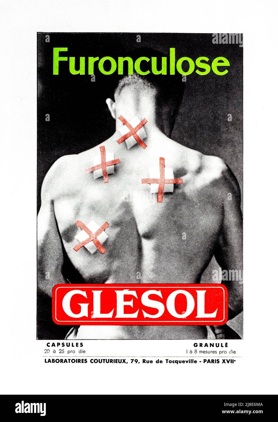 1940/50s Französischer Werbespot für das Medikament „Glésol“. Stockfoto