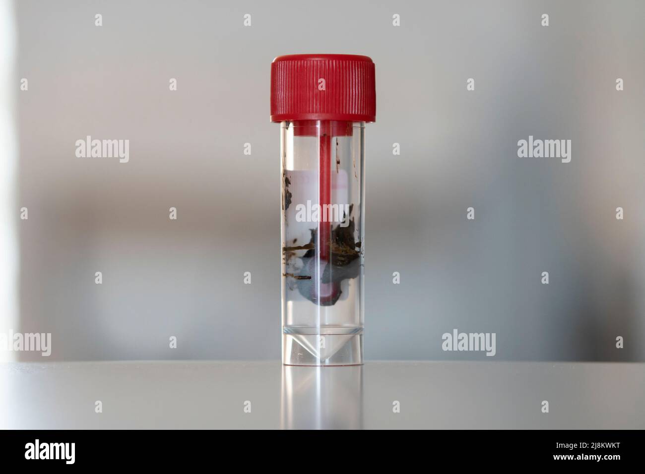 Stuhl, der zur Analyse des menschlichen Stuhls in einem Stuhluntersuchungsbehälter gesammelt wurde Stockfoto